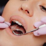 What Qualifies as a Dental Emergency? Know When to Seek an Emergency Dentist in Sugar Land