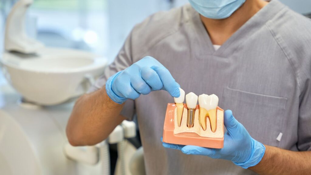 The Life-Changing Effects of Dental Implants