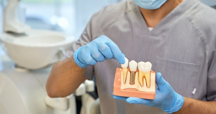 The Life-Changing Effects of Dental Implants